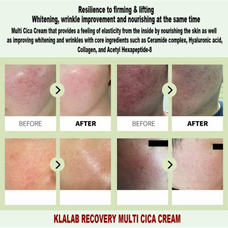 کرم مرطوب‌ کننده و ترمیم‌ کننده سد دفاعی پوست سوپر سیکا برند کلالب KLALAB Recovery Multi CICA Cream 80ml