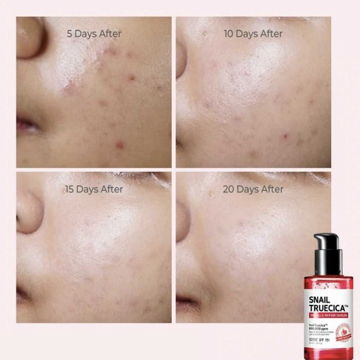 سرم حلزون سیاه ترمیم کننده و تسکین دهنده پوست سام بای می اسنیل تروسیکا Some By Mi Snail Truecica Miracle Repair Serum