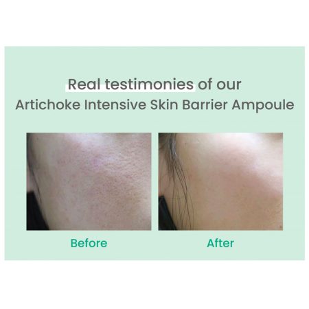 آمپول آرتیشو اکسیس وای ضد جوش و تقویت سد دفاعی پوست AXIS-Y Artichoke Intensive Skin Barrier Ampoule 30ml