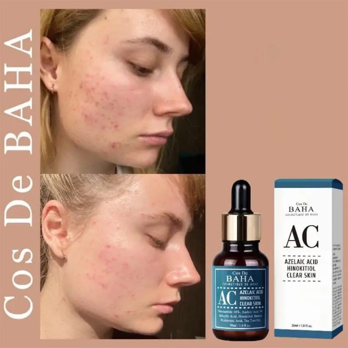 سرم ضد جوش همه کاره آزلائیک اسید کاز دی باها Cos De BAHA Azelaic Acid Hinokitiol Clear Skin Serum 30ml