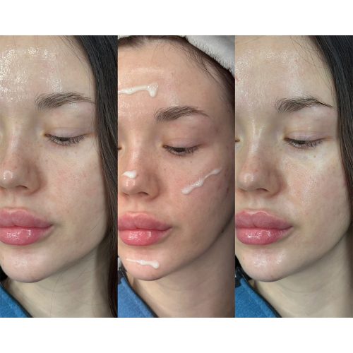 ضد آفتاب مرطوب کننده عمیق دکتر سراکل Dr.Ceuracle Hyal Reyouth Moist Sun SPF50+ PA++++ 50ml