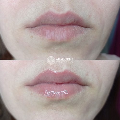 ماسک لب شب توت فرنگی لانیژ Laneige Lip Sleeping Mask EX Berry 20g