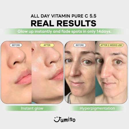 سرم ضد لک و روشن کننده ویتامین سی 5.5 درصد جومیسو Jumiso All Day Vitamin Pure C 5.5 Glow Serum 30ml