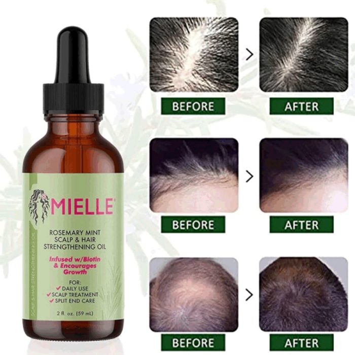 روغن ضد ریزش مو رزماری و نعناع میله Mielle Organics Rosemary Mint Scalp & Hair