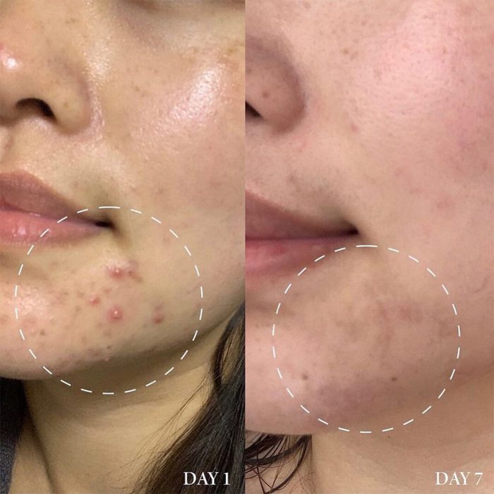 سرم ضد لک و جوش اکسیس وای AXIS-Y Spot The Difference Blemish Treatment