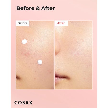 لوسیون نقطه ای ضد لک و جوش کوزارکس COSRX AC Blemish Spot Drying Lotion