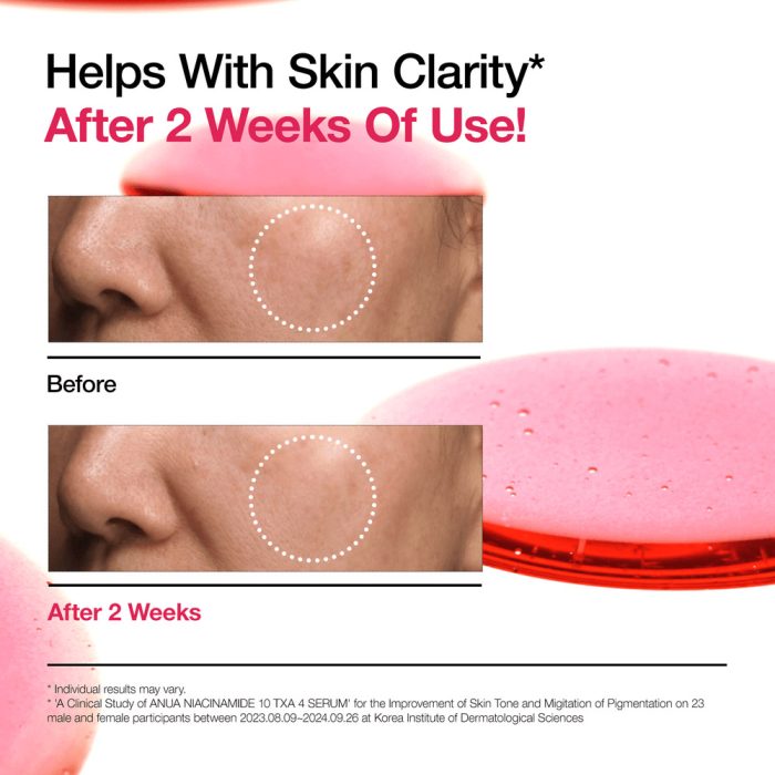 سرم ضد لک نیاسینامید 10% + ترانگزامیک اسید 4% آنوا Anua Niacinamide 10% + TXA 4% Dark Spot Correcting Serum