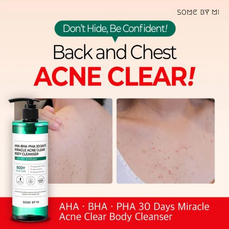 شوینده بدن ضد جوش و آبرسان 30 روزه میراکل سام بای می SOME BY MI AHA BHA PHA 30 days Miracle Acne Body Cleanser