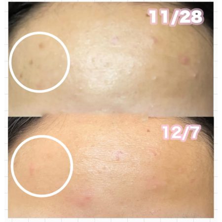 سرم ضد چروک و روشن کننده نانو رتینول 0.3 درصد و نیاسین آنوا Anua Nano Retinol 0.3 % + Niacin Renewing Serum