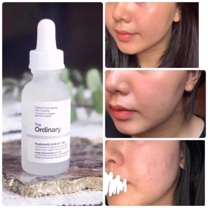 سرم آبرسان هیالورونیک اسید 2% و ویتامین B5 اوردینری The Ordinary Hyaluronic Acid 2% + B5