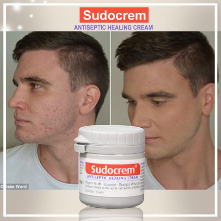 کرم ترمیم کننده و ضد سوختگی سودوکرم Sudocrem Antiseptic Healing Cream