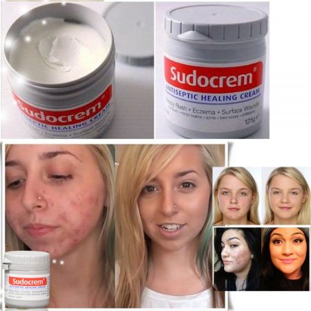 کرم ترمیم کننده و ضد سوختگی سودوکرم Sudocrem Antiseptic Healing Cream