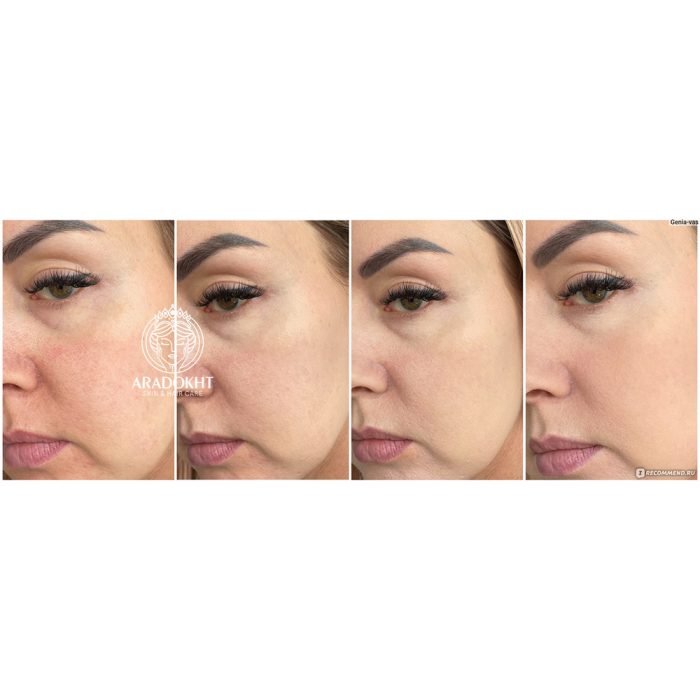 کرم درمان و اصلاح رنگ پوست دکتر جارت Dr.Jart+ Cicapair Tiger Grass Color Correcting Treatment