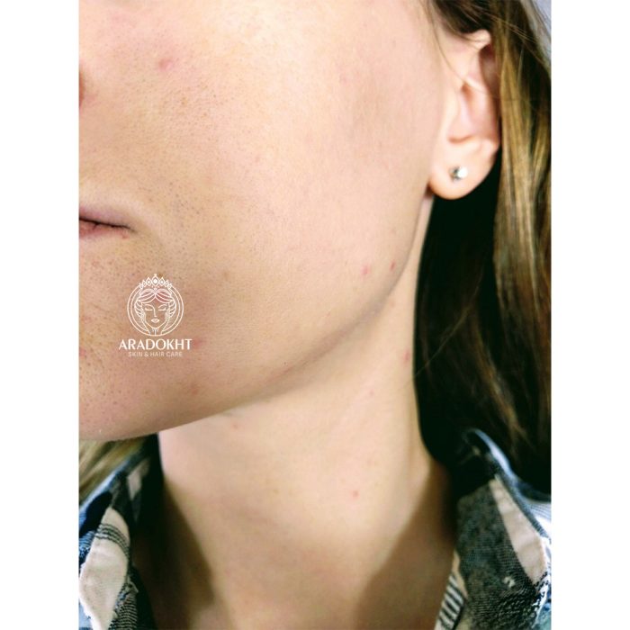 کرم درمان و اصلاح رنگ پوست دکتر جارت Dr.Jart+ Cicapair Tiger Grass Color Correcting Treatment