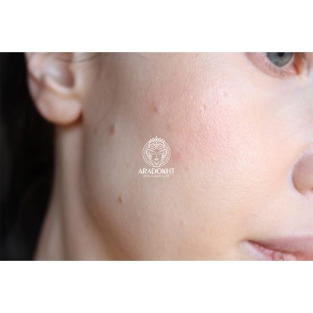 کرم درمان و اصلاح رنگ پوست دکتر جارت Dr.Jart+ Cicapair Tiger Grass Color Correcting Treatment