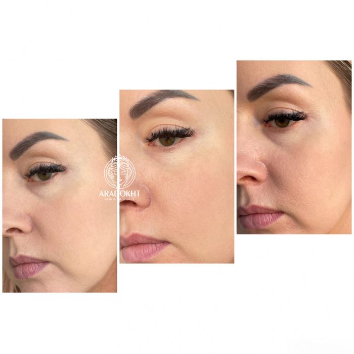 کرم درمان و اصلاح رنگ پوست دکتر جارت Dr.Jart+ Cicapair Tiger Grass Color Correcting Treatment