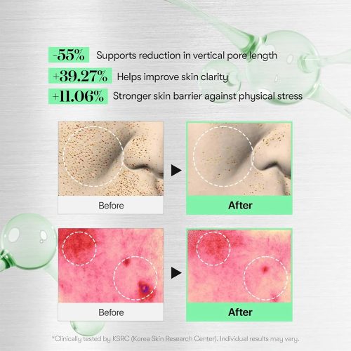 اسنس تقویت کننده و تسکین دهنده ریدل شات 100 وی تی کازمتیک VT COSMETICS CICA Reedle Shot 100 Essence