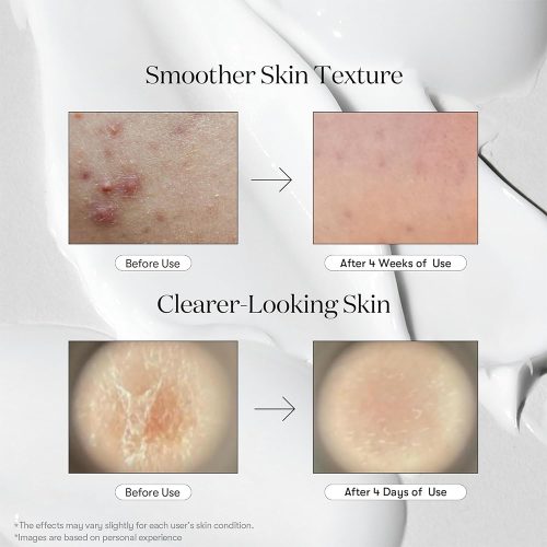 اسنس تقویت کننده و تسکین دهنده ریدل شات 100 وی تی کازمتیک VT COSMETICS CICA Reedle Shot 100 Essence
