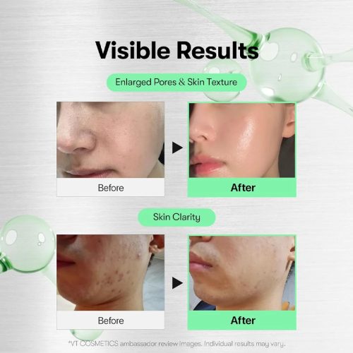 اسنس تقویت کننده و تسکین دهنده ریدل شات 100 وی تی کازمتیک VT COSMETICS CICA Reedle Shot 100 Essence