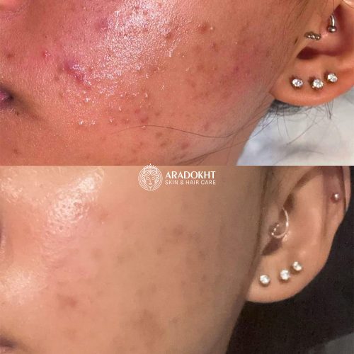کرم ترمیم کننده دکتر التیا Dr. Althea 345 Relief Cream