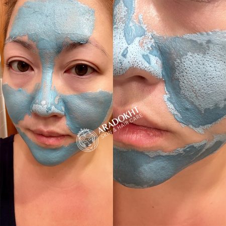 ماسک کنترل منافذ و ضدجوش سرسیاه مدی کیوب Medicube Zero Pore Blackhead Mud Mask