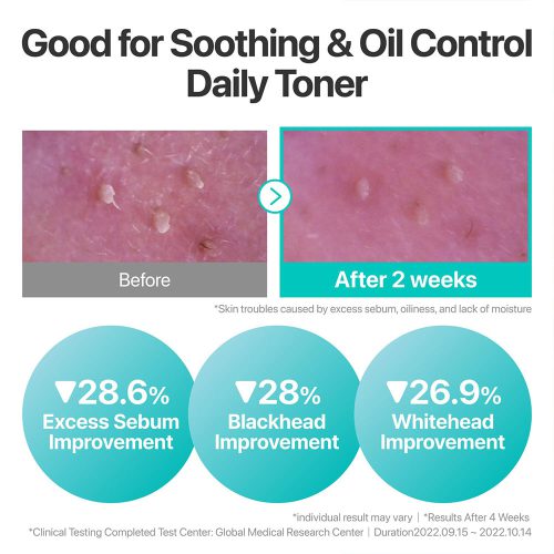 تونر شماره 1 نامبوزین تسکین دهنده پوست Numbuzin No.1 Pure-full Calming Herb Toner