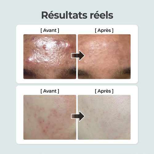 تونر شماره 1 نامبوزین تسکین دهنده پوست Numbuzin No.1 Pure-full Calming Herb Toner