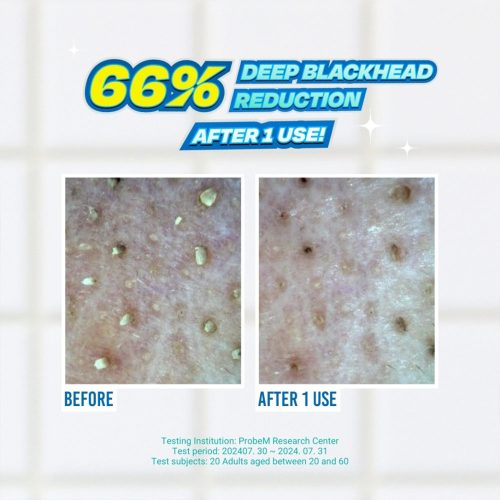ست کنترل منافذ و ضد جوش جومیسو JUMISO Blackhead Melting Softener & Cotton Pad Set
