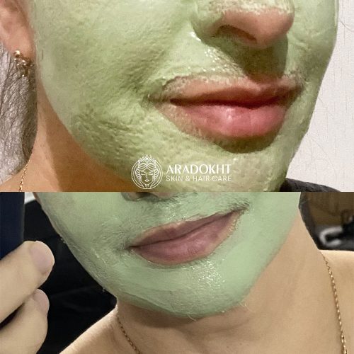 پک ماسک کنترل منافذ و تسکین دهنده خاک رس و چای سبز اسکین 1004 SKIN1004 Witch Pack Creamy Mud Pack with Green Tea