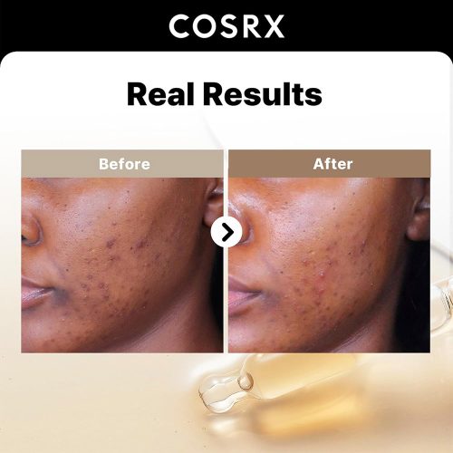 سرم آلفا آربوتین 2 درصد کوزارکس ضد لک و روشن کننده پوست COSRX The Alpha-Arbutin 2 Discoloration Care serum