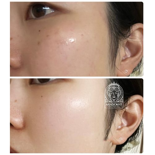 سرم آلفا آربوتین 2 درصد کوزارکس ضد لک و روشن کننده پوست COSRX The Alpha-Arbutin 2 Discoloration Care serum