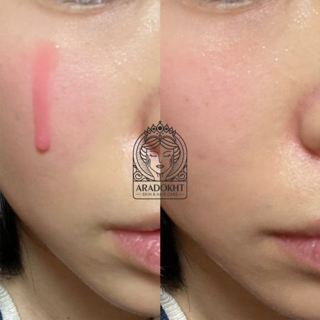 سرم صورتی روشن کننده پپتاید و PDRN مدی کیوب Medicube PDRN Pink Peptide Serum