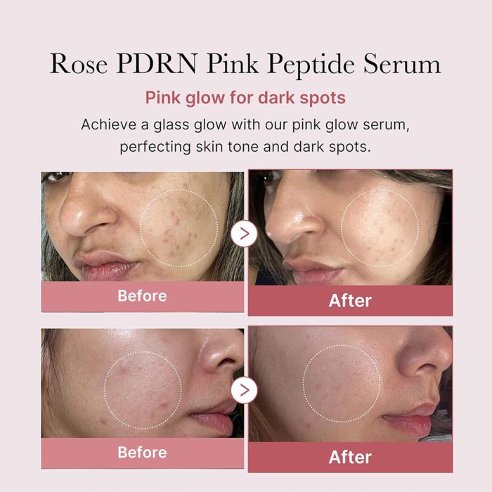 سرم صورتی روشن کننده پپتاید و PDRN مدی کیوب Medicube PDRN Pink Peptide Serum