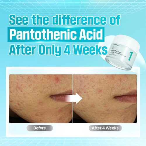 سوتینگ کرم شماره 1 نامبوزین مرطوب کننده و تسکین دهنده پوست Numbuzin No.1 Pantothenic B5 Active Soothing Cream