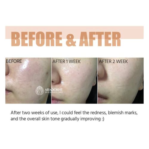 سرم ضد لک و قرمزی گودبای بلمیش شماره 5 نامبوزین Numbuzin No.5 Goodbye Blemish Serum