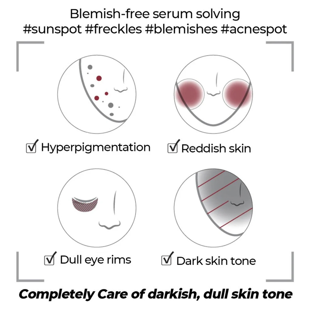 سرم ضد لک و قرمزی گودبای بلمیش شماره 5 نامبوزین Numbuzin No.5 Goodbye Blemish Serum - تصویر 21