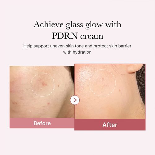 کرم مرطوب کننده هیالورونیک و PDRN مدی کیوب Medicube PDRN Pink Hyaluronic Moisturizing Cream