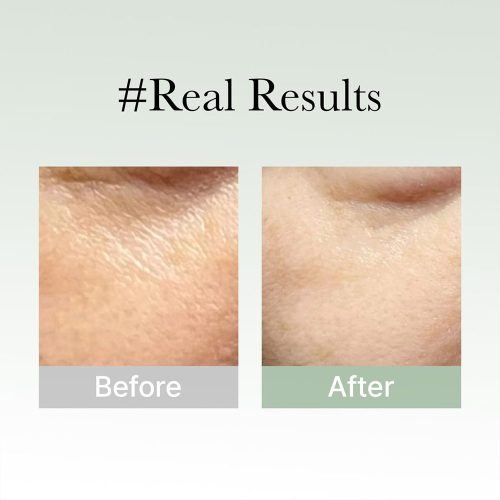 سرم ماسک تسکین دهنده و درخشان کننده زوفا مقدس آرنسیا Arencia Holy Hyssop Serum 30