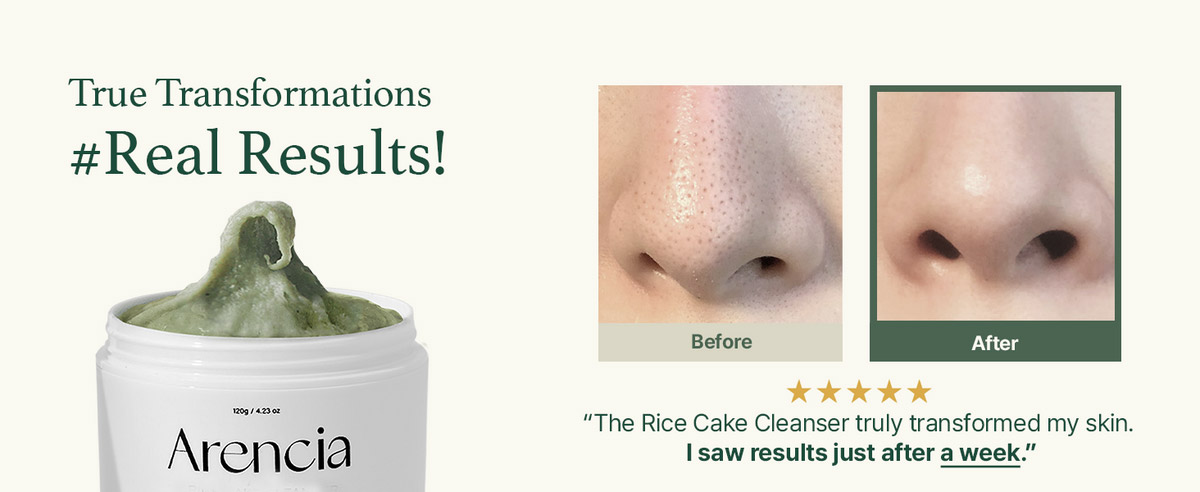 پاک کننده عمقی موچی برنج و چای سبز آرنسیا تسکین دهنده و کنترل چربی پوست Arencia Fresh Green Rice Mochi Cleanser