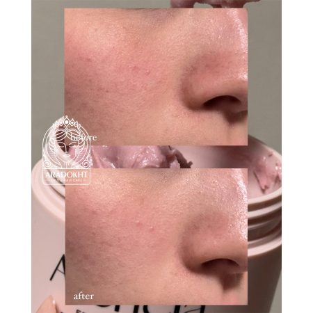 پاک کننده عمقی موچی رزهیپ آرنسیا روشن کننده پوست Arencia - Fresh Rosehip Rice Mochi Cleanser