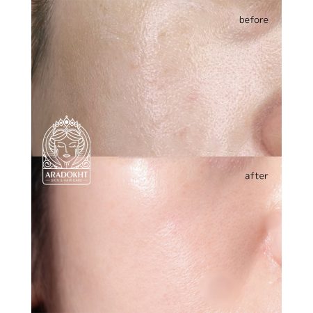 پاک کننده عمقی موچی رزهیپ آرنسیا روشن کننده پوست Arencia - Fresh Rosehip Rice Mochi Cleanser