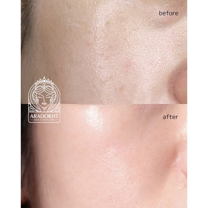 پاک کننده عمقی موچی رزهیپ آرنسیا روشن کننده پوست Arencia - Fresh Rosehip Rice Mochi Cleanser