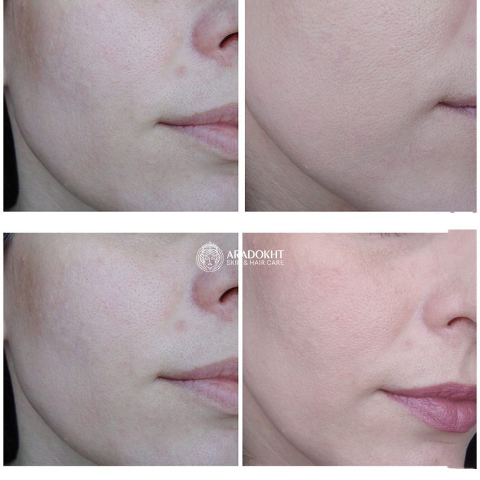 بی بی کرم مورینگا سرامید هیمیش Heimish Moringa Ceramide BB Cream SPF 30