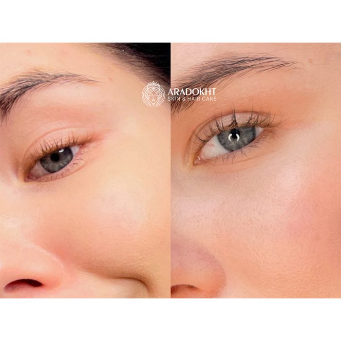 سرم تقویت مژه اتود Etude My Lash Serum