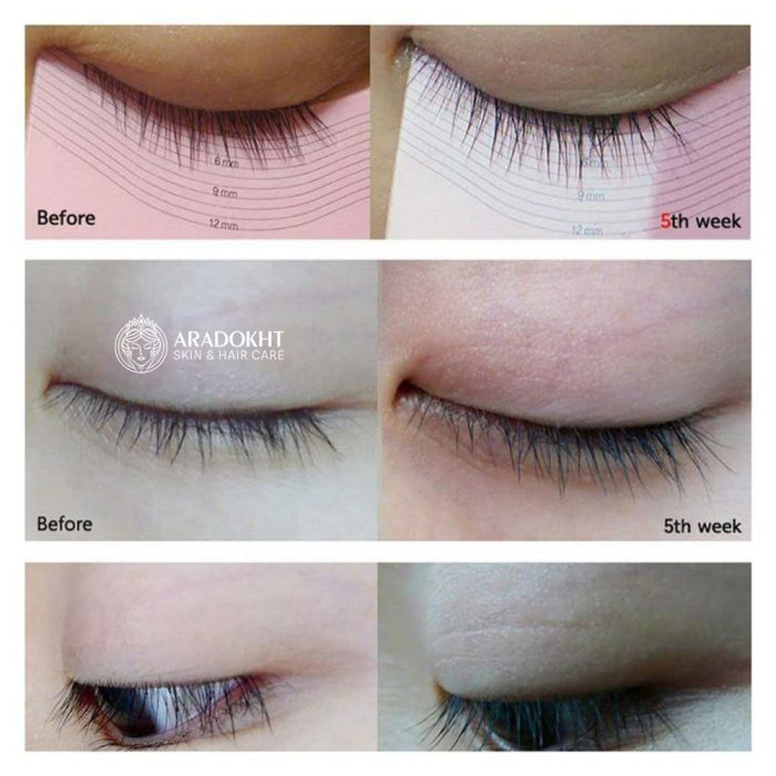 سرم تقویت مژه اتود Etude My Lash Serum