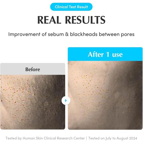 پد تونر آبرسان و تسکین دهنده اکوال بری EQQUALBERRY Swimming Pool Toner Pads