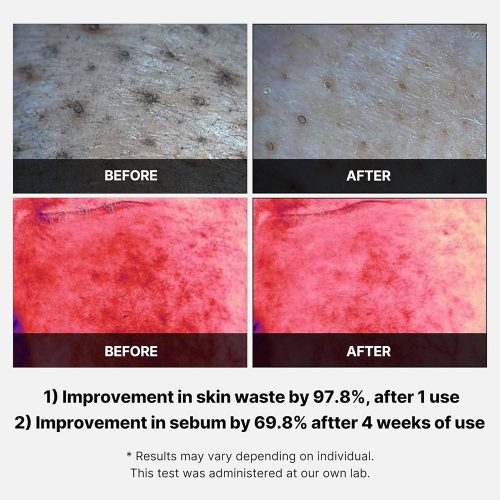 پد تونر ضد جوش و لایه بردار سوکسینیک اسید مدی کیوب Medicube Red Succinic Acid Peeling Pad