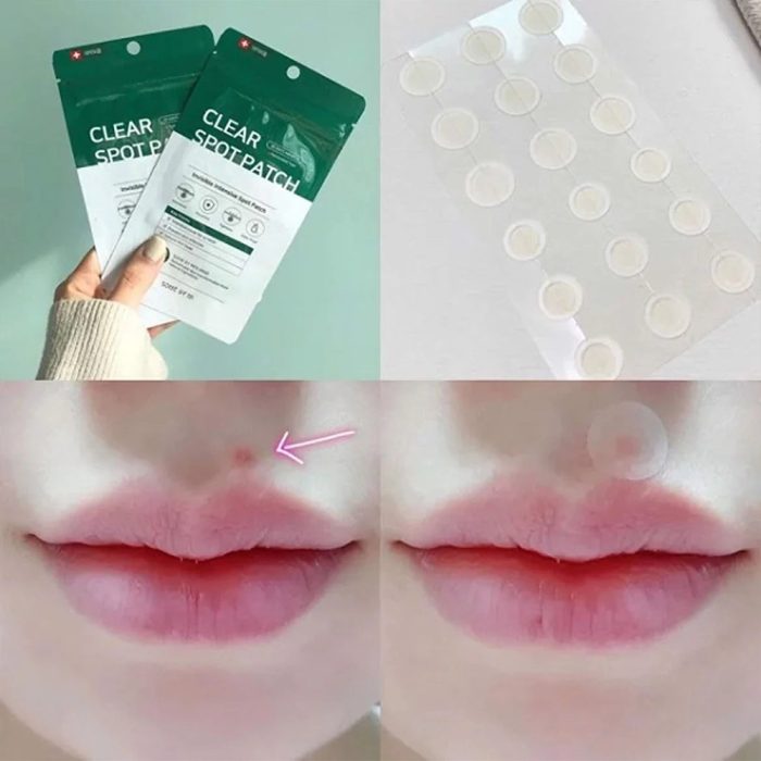 پچ ضد جوش و آکنه میراکل سام بای می SOMEBYMI 30 days Miracle Clear Spot Patches