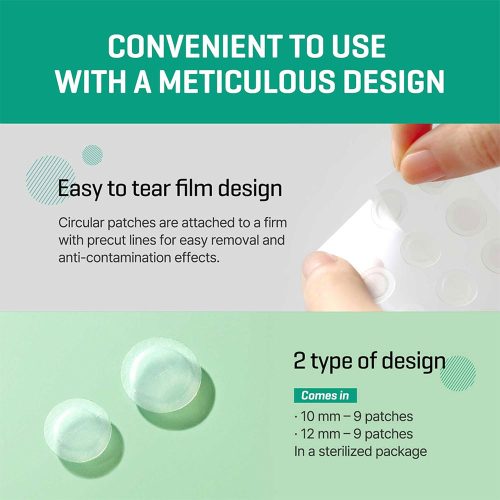 پچ ضد جوش و آکنه میراکل سام بای می SOMEBYMI 30 days Miracle Clear Spot Patches