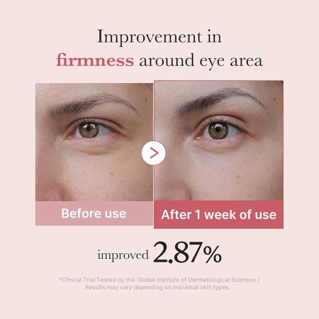 کرم دور چشم pdrn و پپتاید مدی کیوب ضد چروک و روشن کننده PDRN Pink Peptide Eye Cream